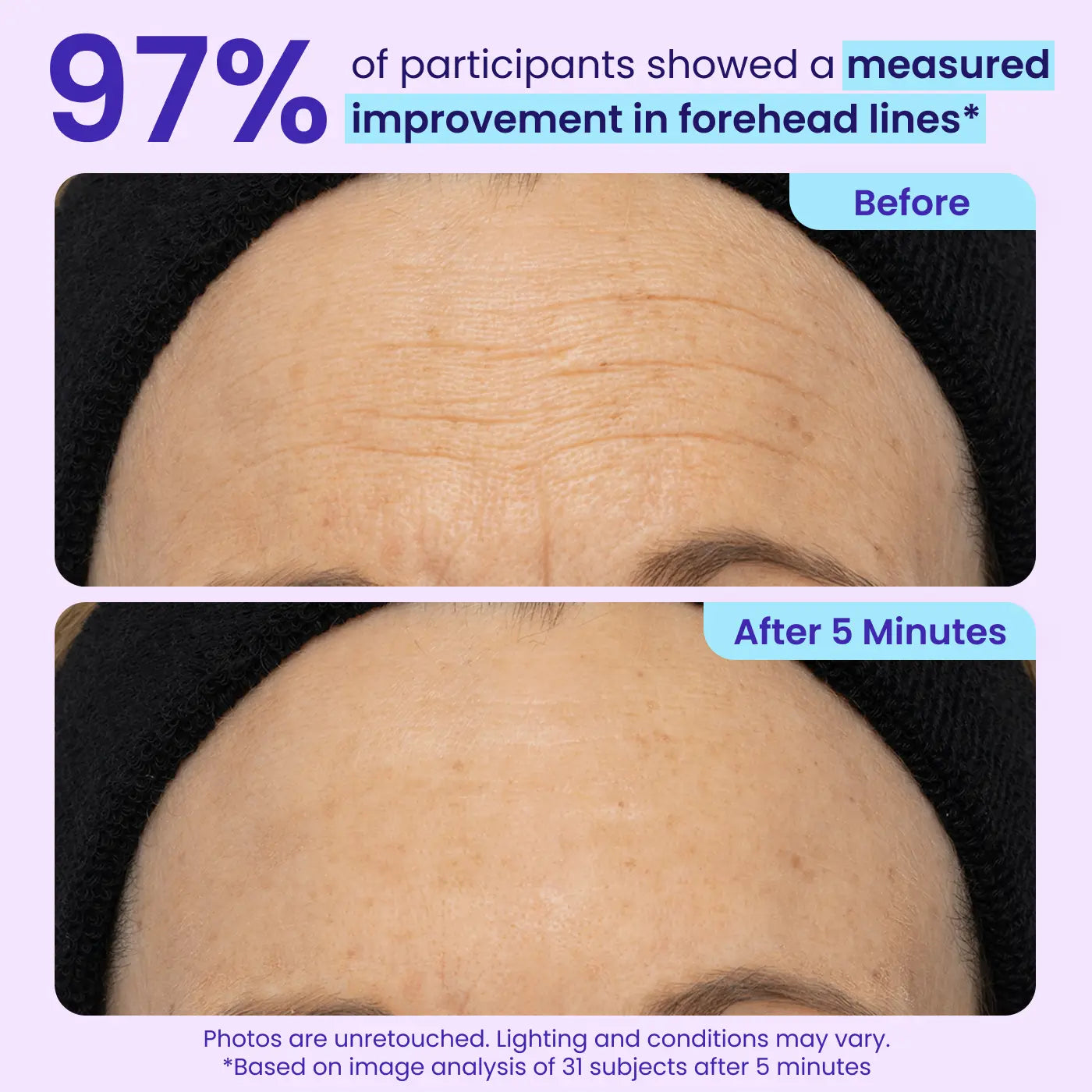 💎Mother's Birthday Gift💓-Erase Eye Bags in Minutes — Look Refreshed Instantly