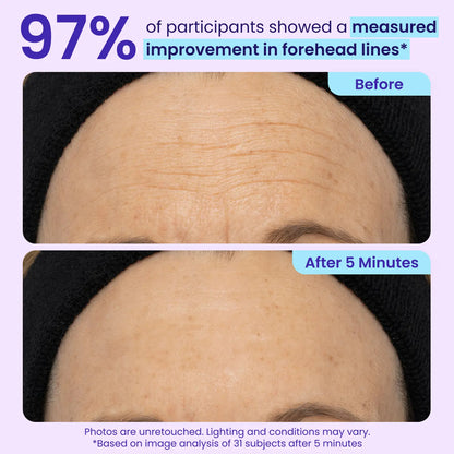 💎Mother's Birthday Gift💓-Erase Eye Bags in Minutes — Look Refreshed Instantly